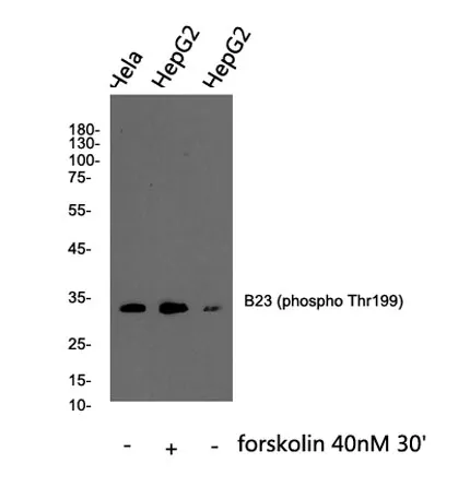 B23 (phospho Thr199) rabbit pAb - image 1