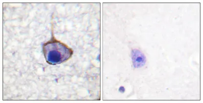 Trk A (phospho Tyr791) rabbit pAb - image 1