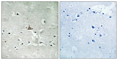 Trk B (phospho Tyr706/Y707) rabbit pAb