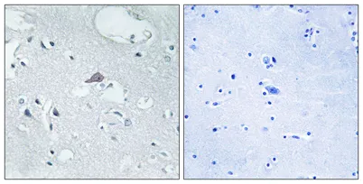 MOR-1 rabbit pAb