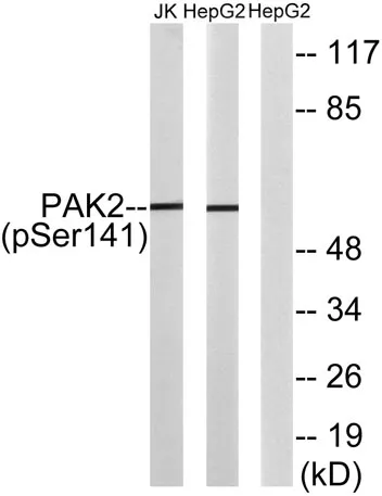 PAKγ (phospho Ser141) rabbit pAb