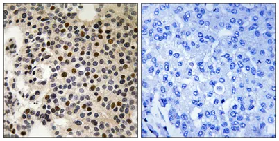 PAKγ (phospho Ser197) rabbit pAb