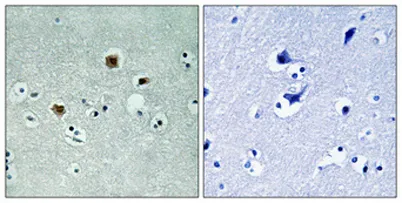 PAKβ rabbit pAb - image 1