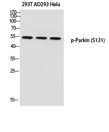Parkin (phospho Ser131) rabbit pAb