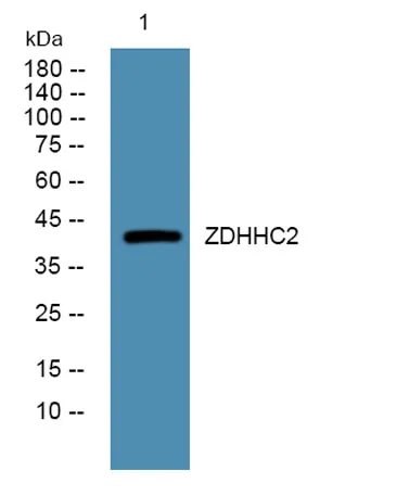 ZDHHC2 rabbit pAb - image 1