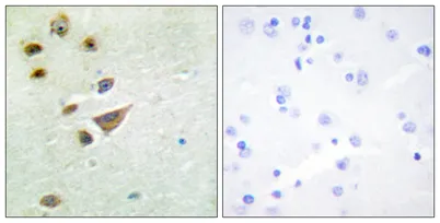 NT5C3 rabbit pAb - image 1