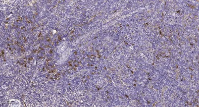 PDGFR-α (phospho Tyr762) rabbit pAb - image 1