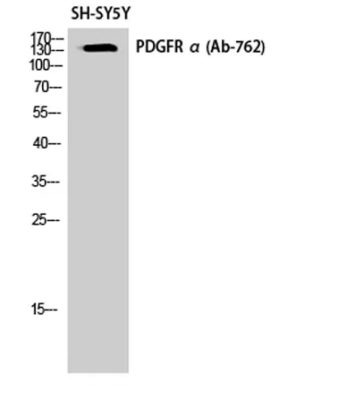 PDGFR-α rabbit pAb - image 1