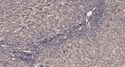 PDGFR-β (phospho Tyr771) rabbit pAb