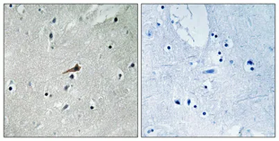 PDGFR-β (phospho Tyr740) rabbit pAb - image 1