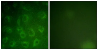 PDGFR-β rabbit pAb - image 1