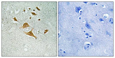 CDK5 Activator-binding C42 rabbit pAb - image 1
