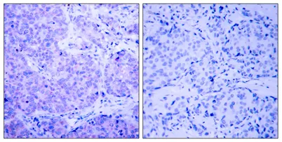 PDHK1 (phospho Ser241) rabbit pAb - image 1