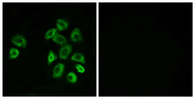 GPRC5B rabbit pAb - image 1