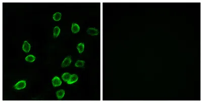 ATP5G3 rabbit pAb - image 1