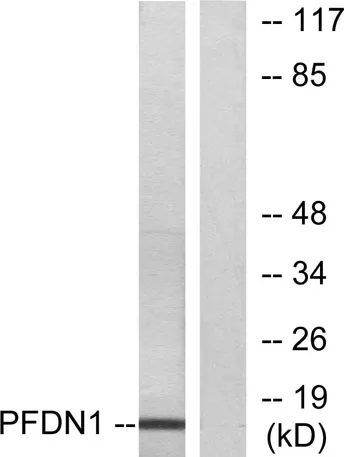 Prefoldin 1 rabbit pAb - image 1
