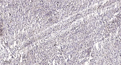 PKD2 (phospho Ser812) rabbit pAb