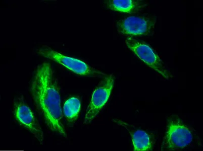 cPLA2 rabbit pAb - image 1