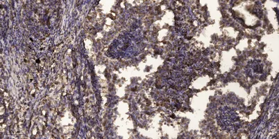 PLC β2 rabbit pAb