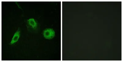 PLC γ2 (phospho Tyr1217) rabbit pAb - image 1