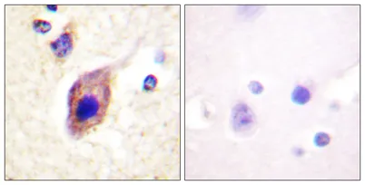 PLC γ2 rabbit pAb
