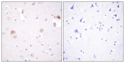 PC-PLD1 rabbit pAb - image 1