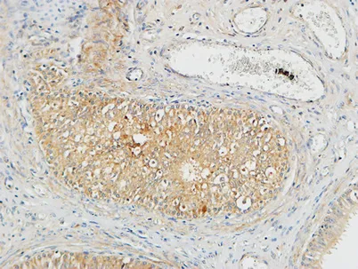 Plasminogen rabbit pAb