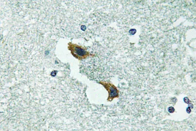 ATP7A rabbit pAb - image 1