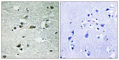 Casein Kinase Iγ1/2/3 (phospho Tyr263) rabbit pAb - image 1
