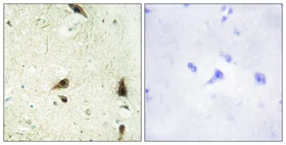 CHRAC15 rabbit pAb