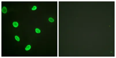 Acetyl Histone H2B (K12) rabbit pAb
