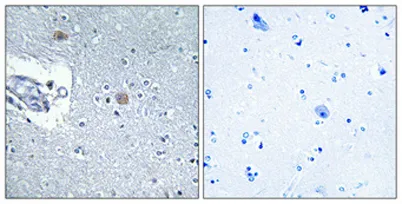 CSGlcA-T rabbit pAb