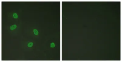 TRAP220 (phospho Thr1457) rabbit pAb