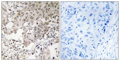 hCAP-G2 rabbit pAb - image 1