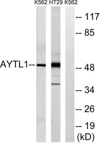 LPCAT2 rabbit pAb - image 1