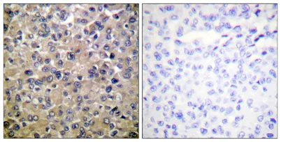 PP1α rabbit pAb - image 1