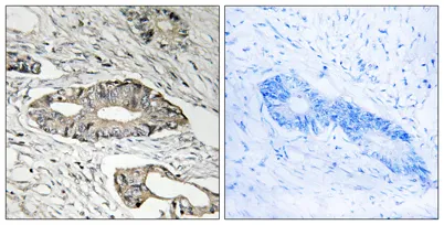 Epsin 3 rabbit pAb - image 1