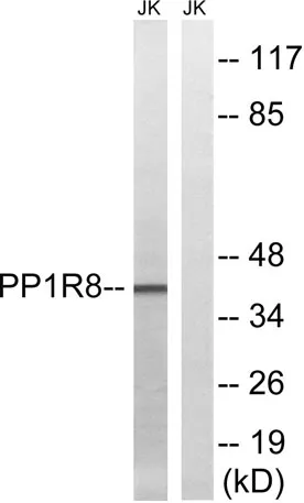 NIPP1 rabbit pAb