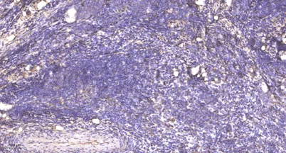 PP2A-B55-β rabbit pAb - image 1
