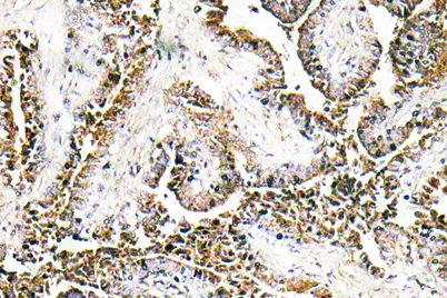 CLN1 rabbit pAb