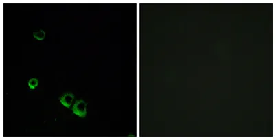 AVP Receptor V2 rabbit pAb