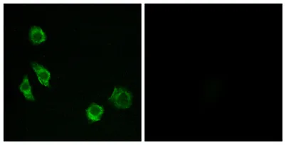 GPRC5D rabbit pAb - image 1