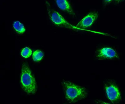 PKAα/β/γ cat (phospho Thr197) rabbit pAb - image 1