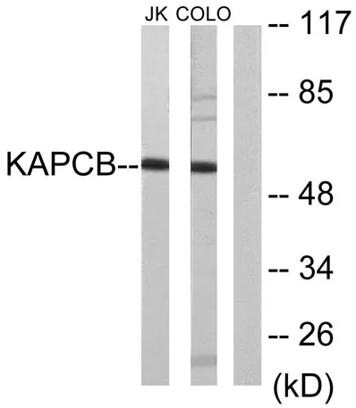 PKAβ cat rabbit pAb - image 1