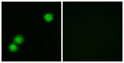 PKI β rabbit pAb