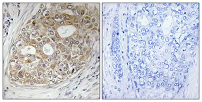 ARF GAP1 rabbit pAb - image 1