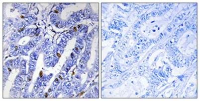 PKA IIβ reg (phospho Ser113) rabbit pAb