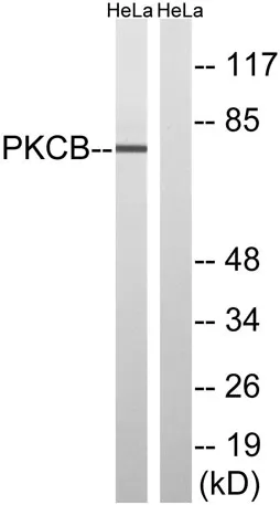 PKC β rabbit pAb