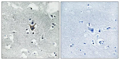 PKC δ rabbit pAb - image 1