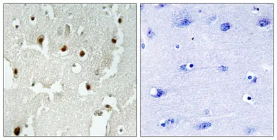 TReP-132 rabbit pAb - image 1